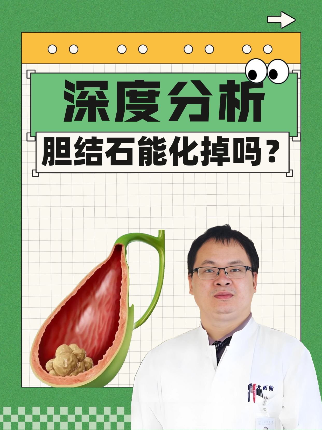 深度分析：胆结石能化掉吗？