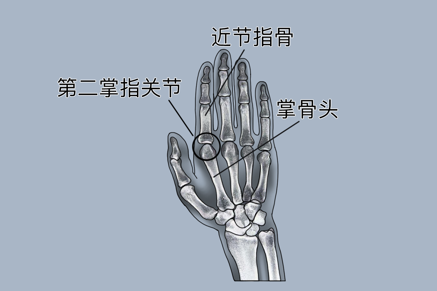 第二掌指关节位置图 第二掌指关节位置图