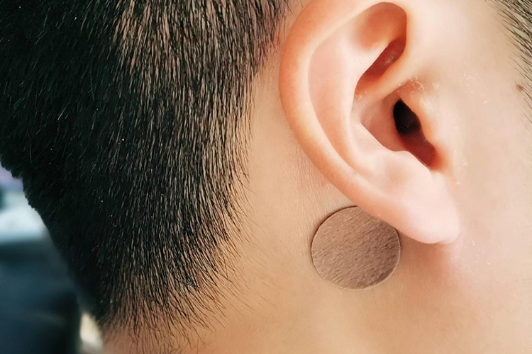 可乐定贴片贴于耳后乳突处位置图