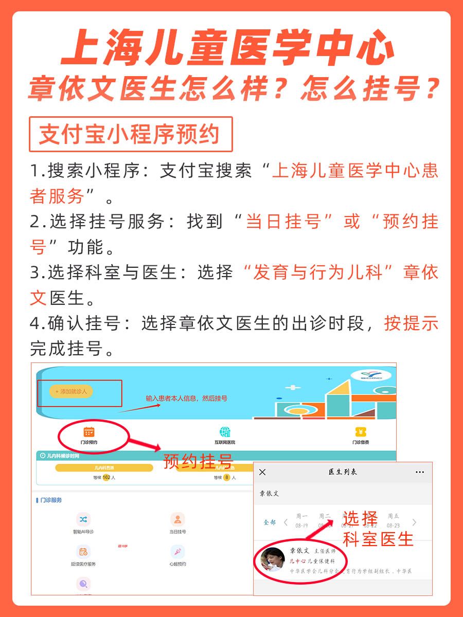 上海儿童医学中心章依文医生怎么样？怎么挂号？