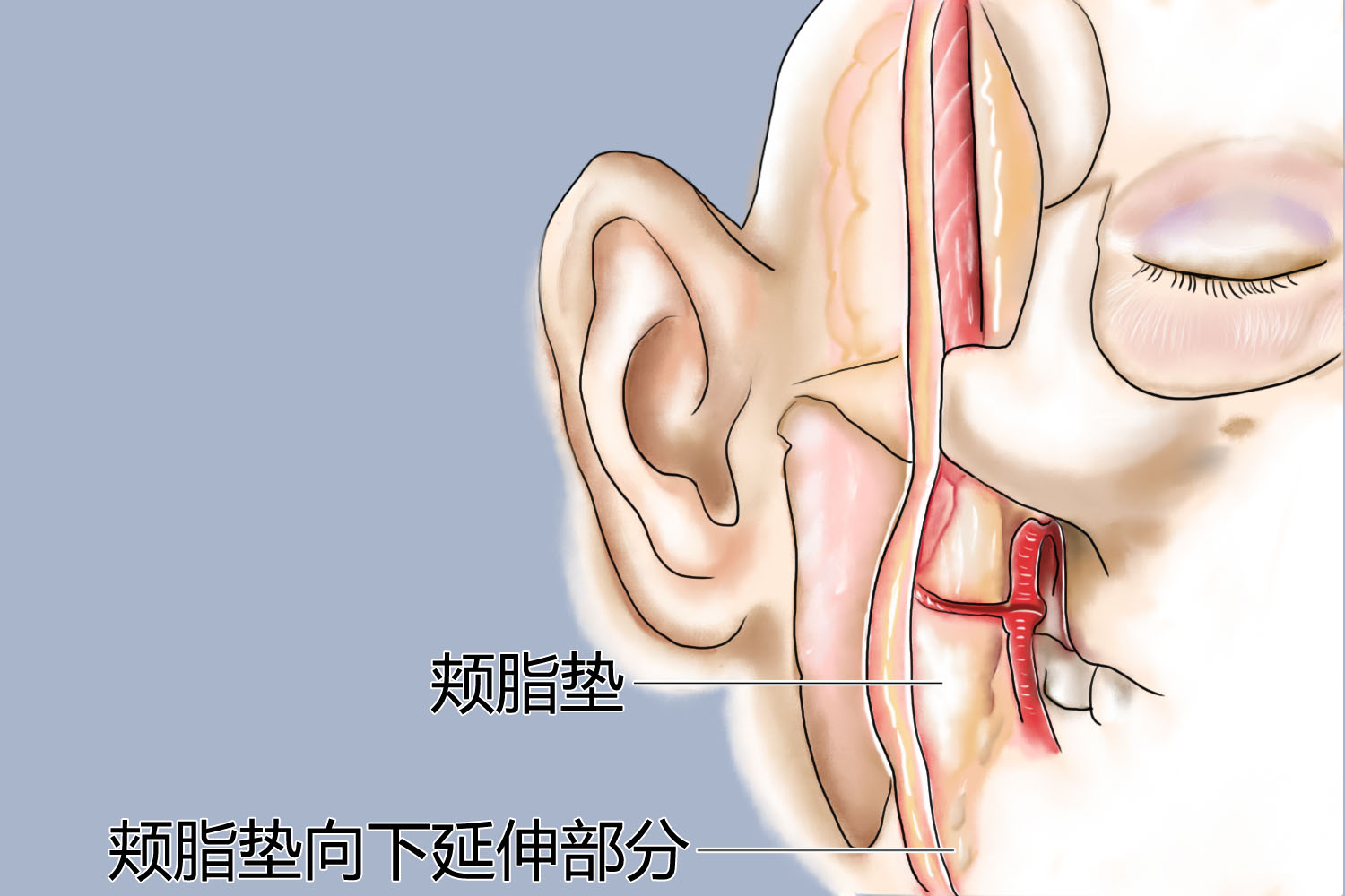 颊脂垫位置图 颊脂垫位置图