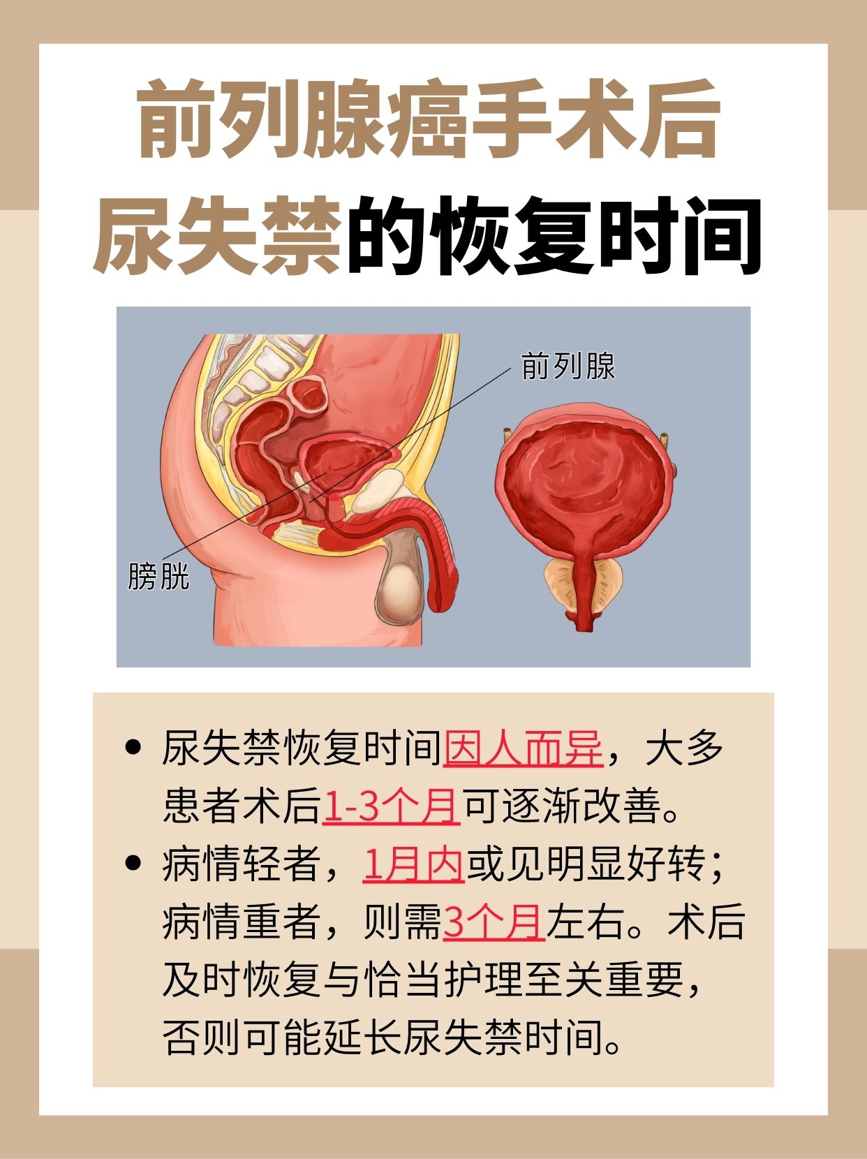 术后尿失禁恢复时间揭秘:前列腺癌患者必看!