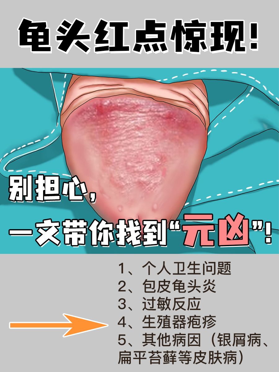 龟头红点惊现！别担心，一文带你找到“元凶”！