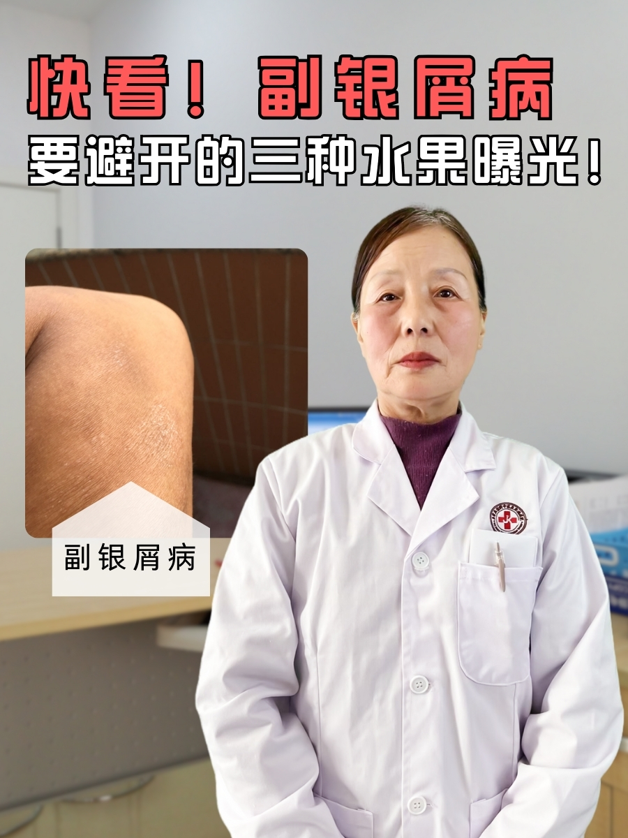 快看！副银屑病要避开的三种水果曝光！