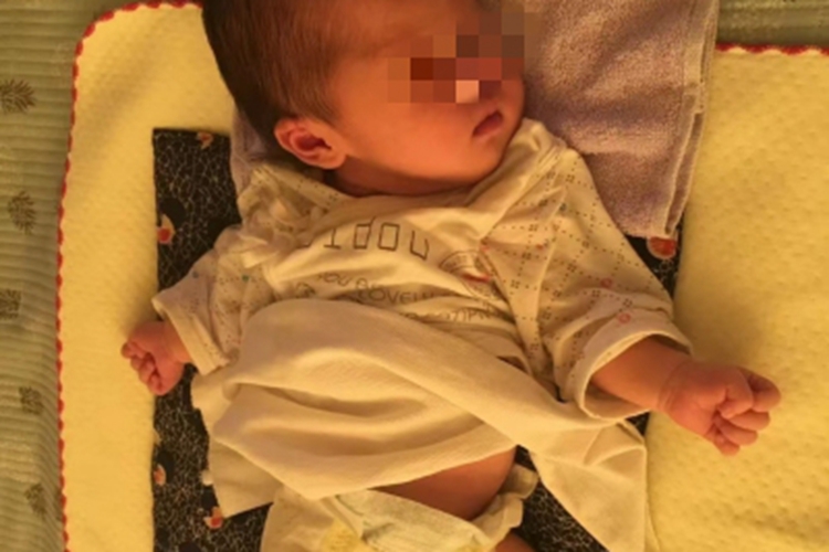 软骨发育不良胳膊变形图