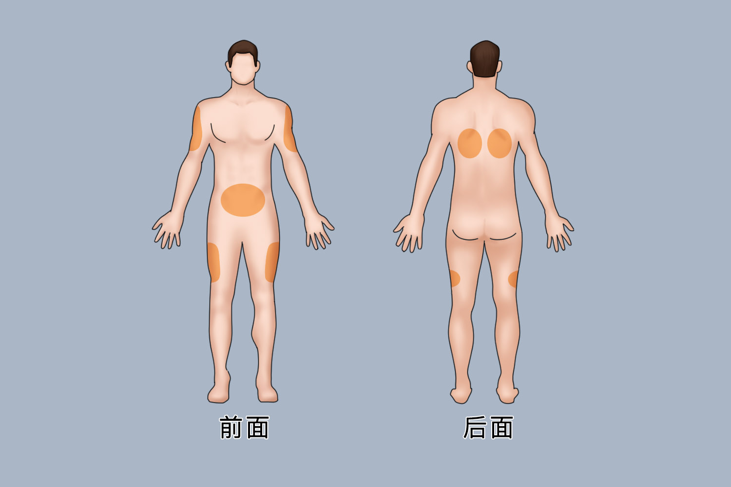 皮下注射部位图