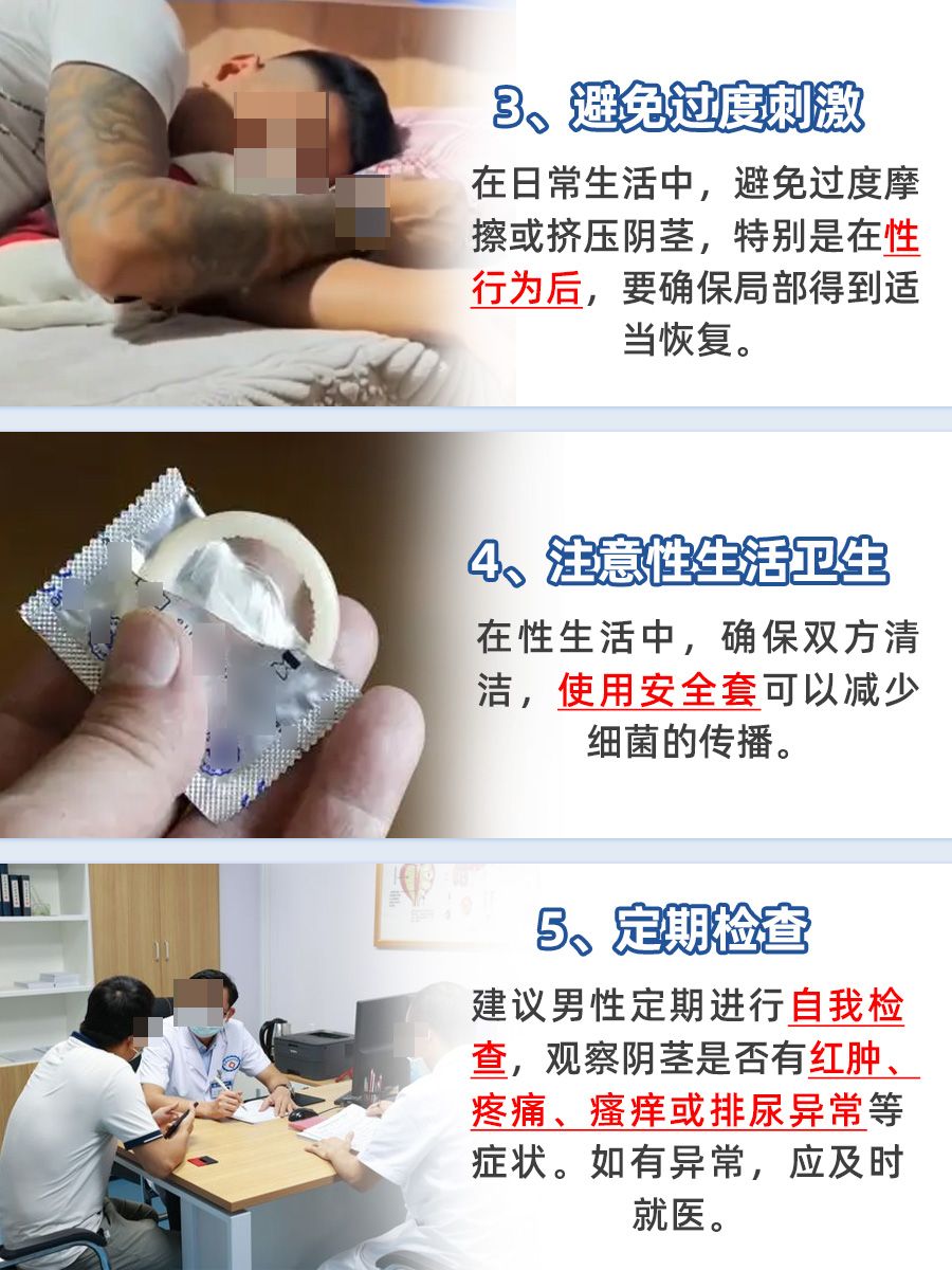 包皮那些事：不割的选择与智慧