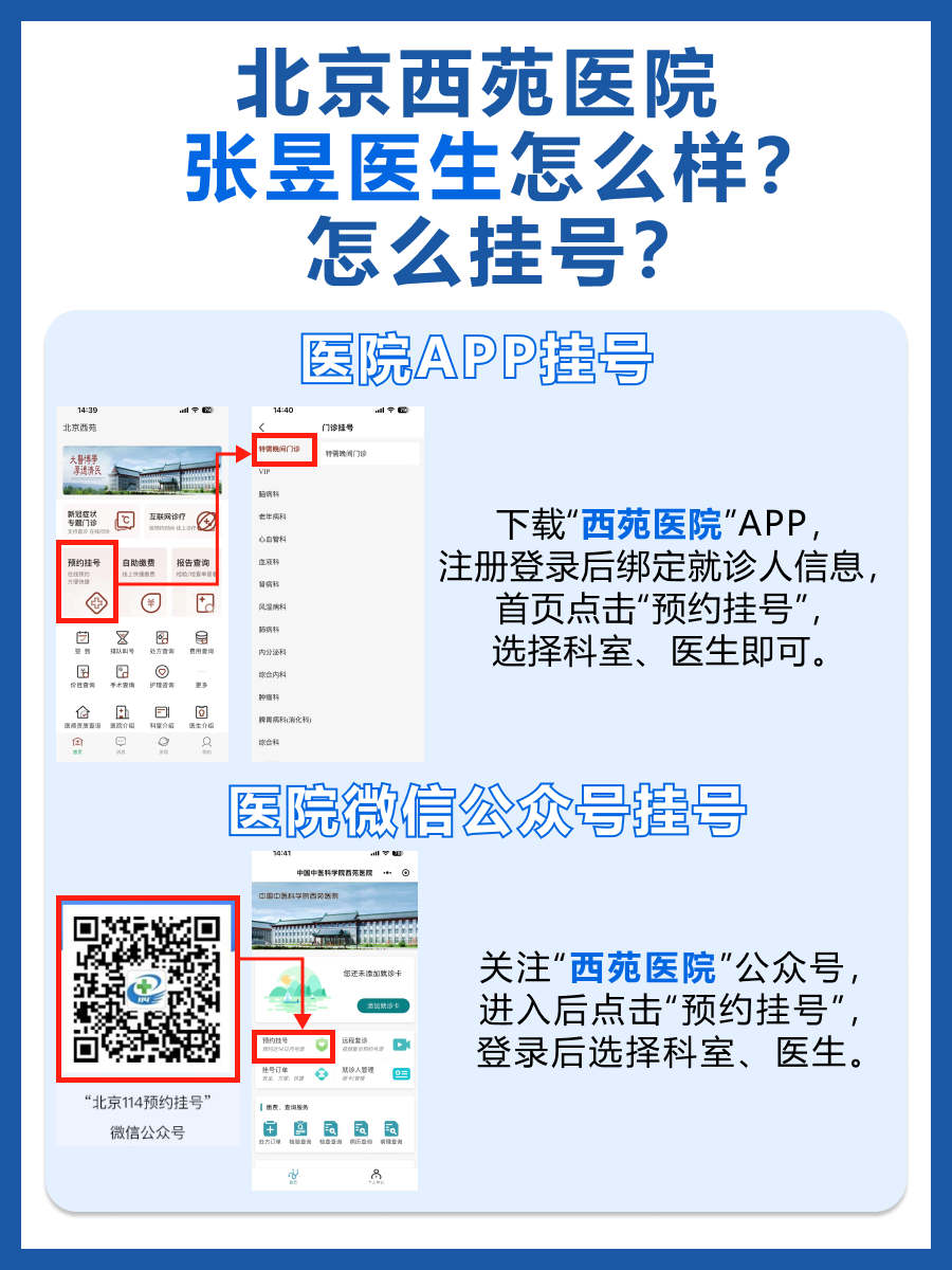 北京西苑医院张昱医生怎么样？怎么挂号？