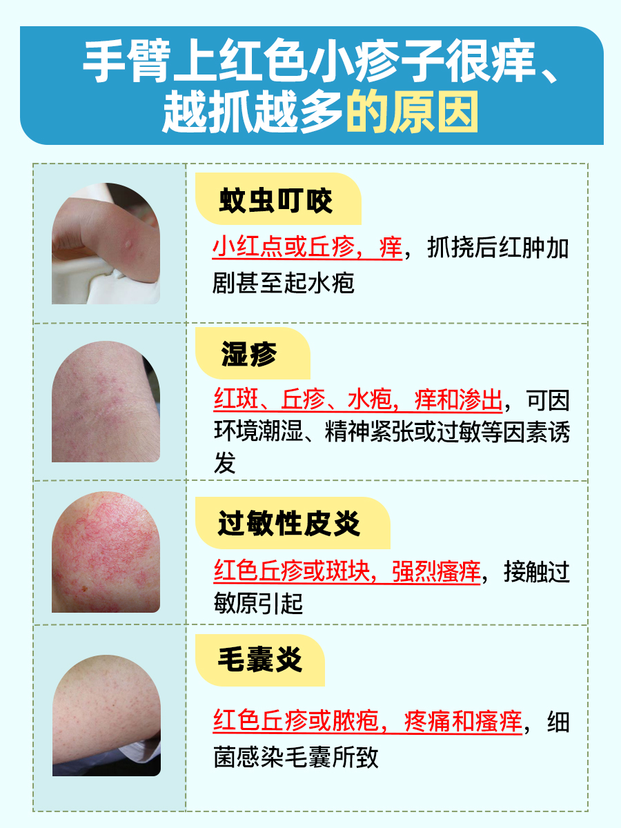 手臂上红色小疹子很痒越抓越多,是怎么回事?