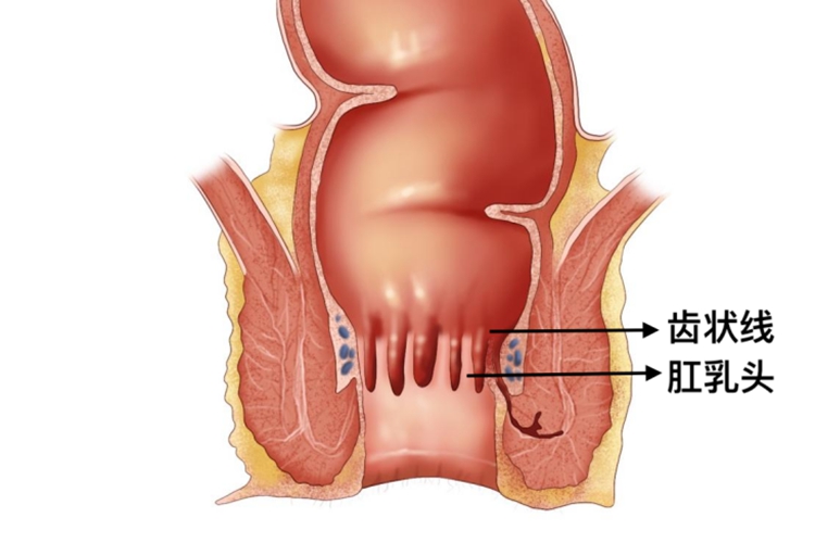 齿状线距肛缘图片