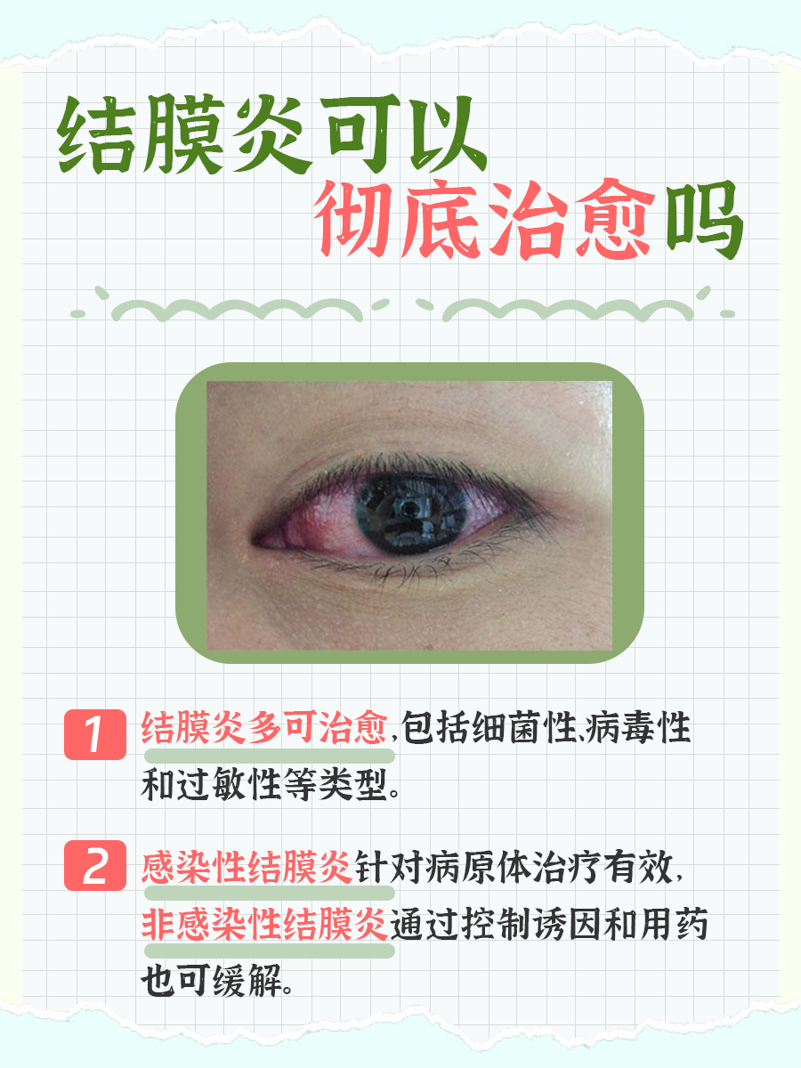 一文解析：结膜炎可以彻底治愈吗