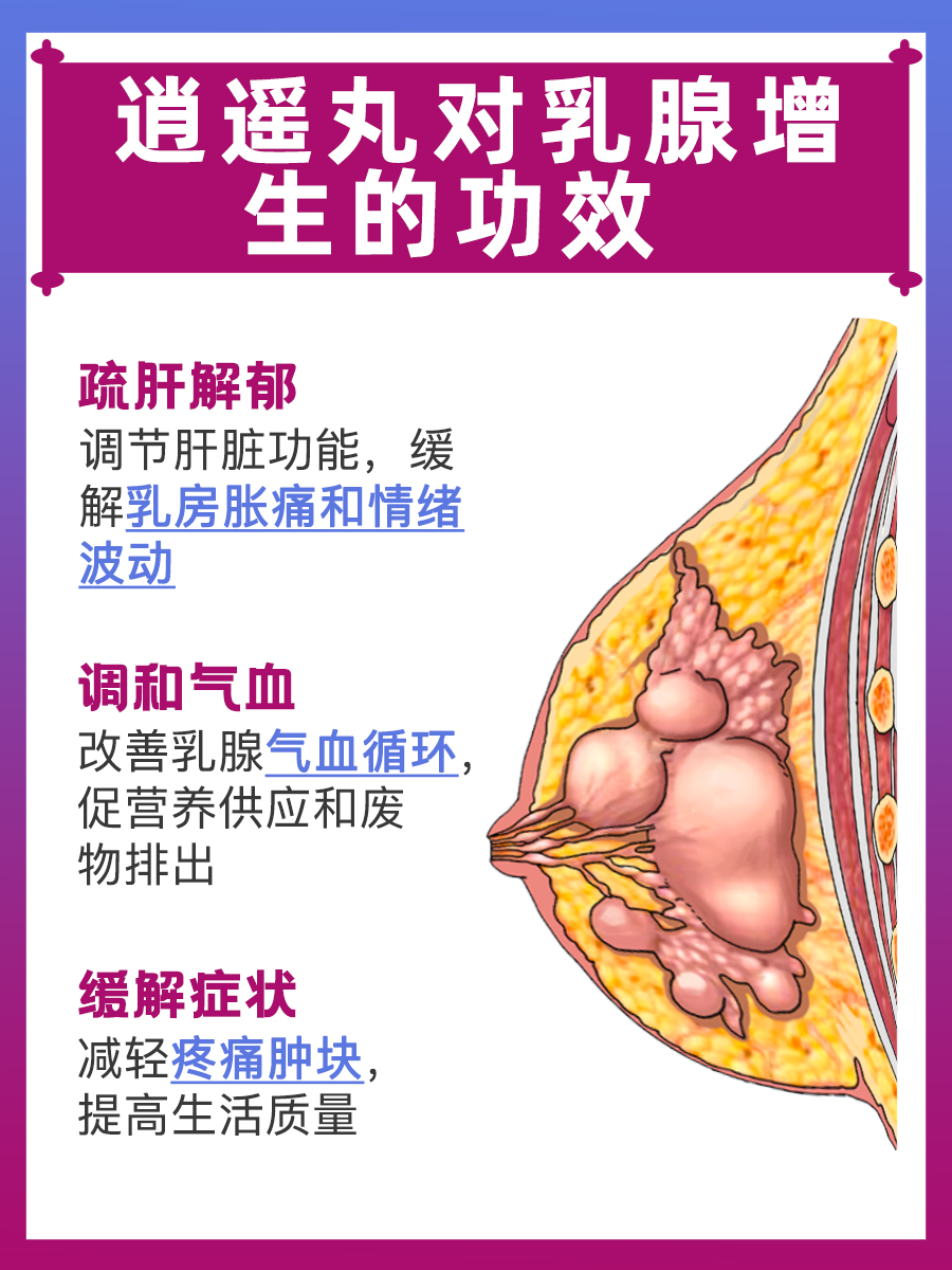 大揭秘！乳腺增生吃逍遥丸有效吗？