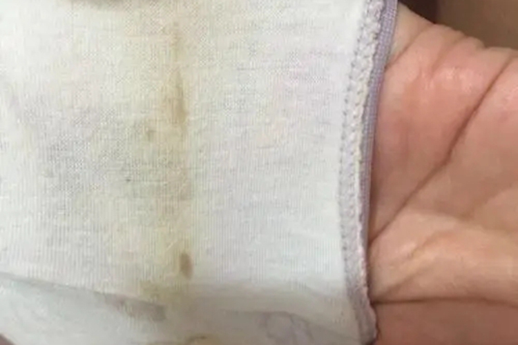 受精卵着床分泌物图 受精卵着床分泌物图