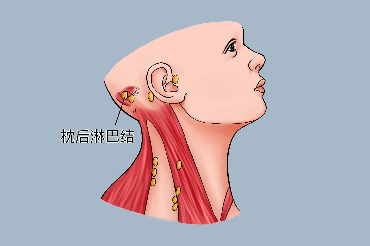 枕后两侧淋巴结位置图图片