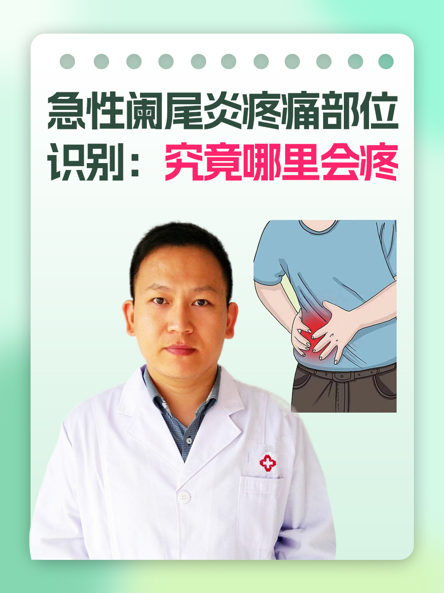 急性阑尾炎疼痛部位识别：究竟哪里会疼