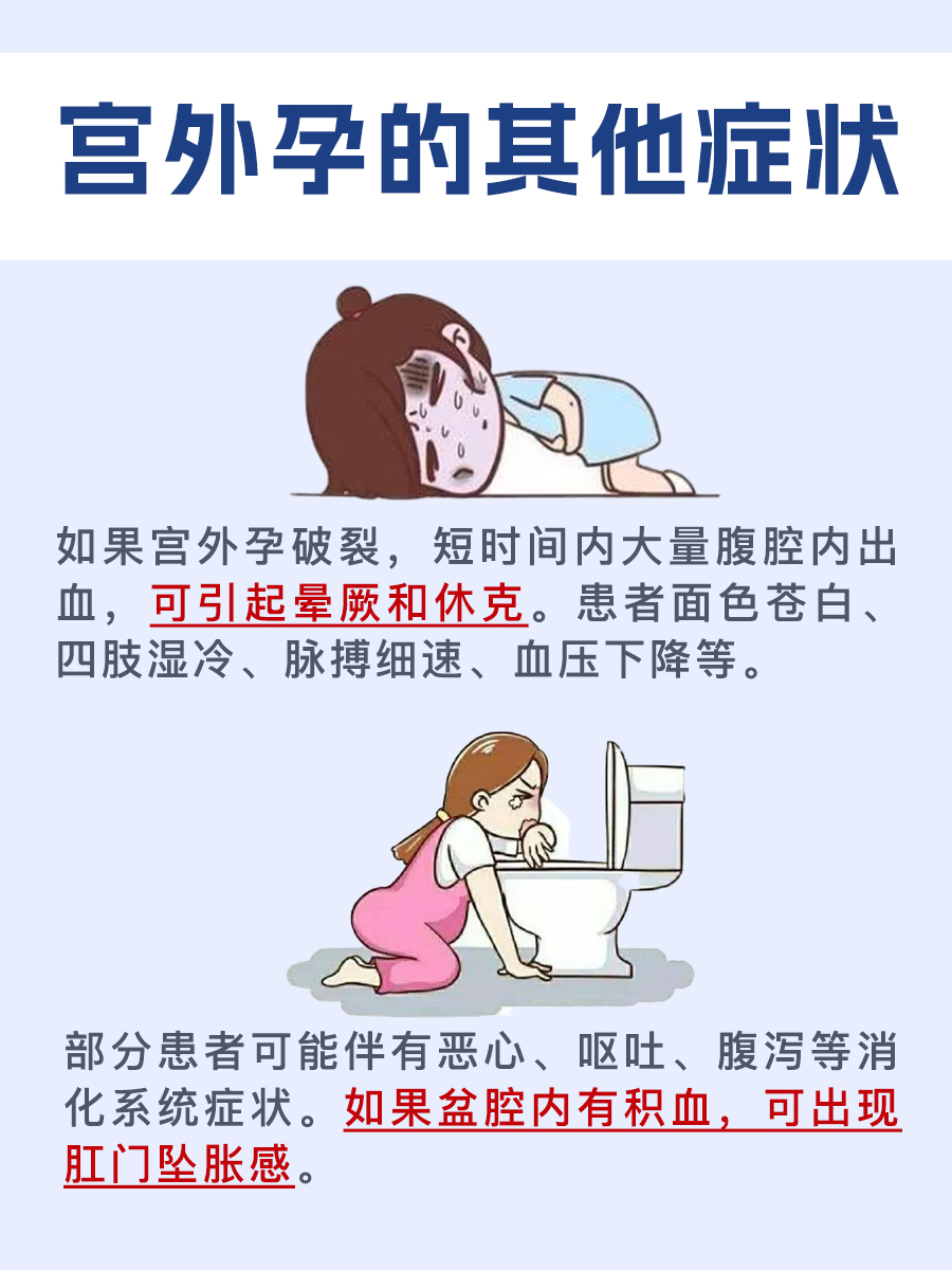 一文了解：宫外孕会是一条杠吗？