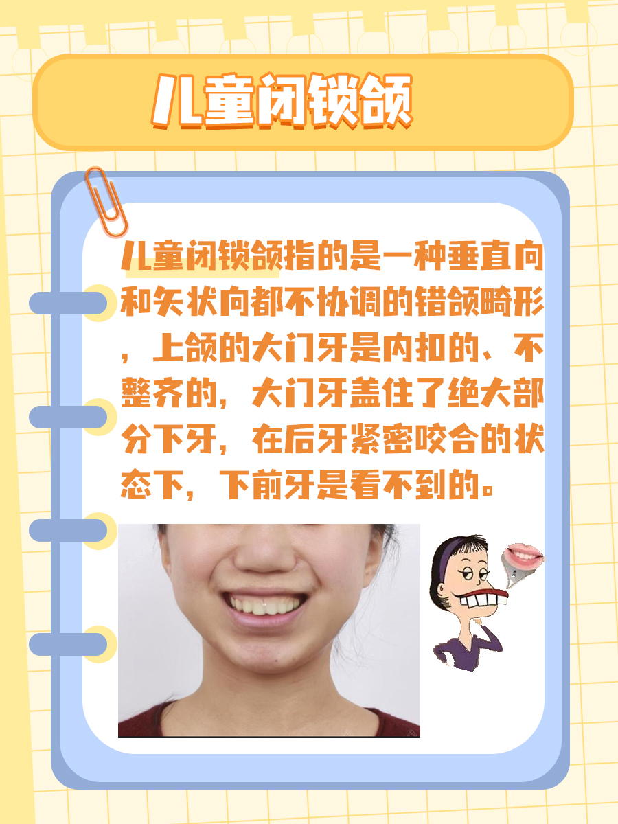 儿童闭锁颌是何物?一起来看看!