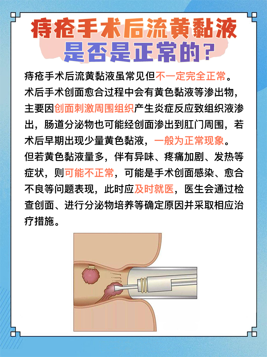 痔疮手术后流黄色黏液，正常与否，答案来了