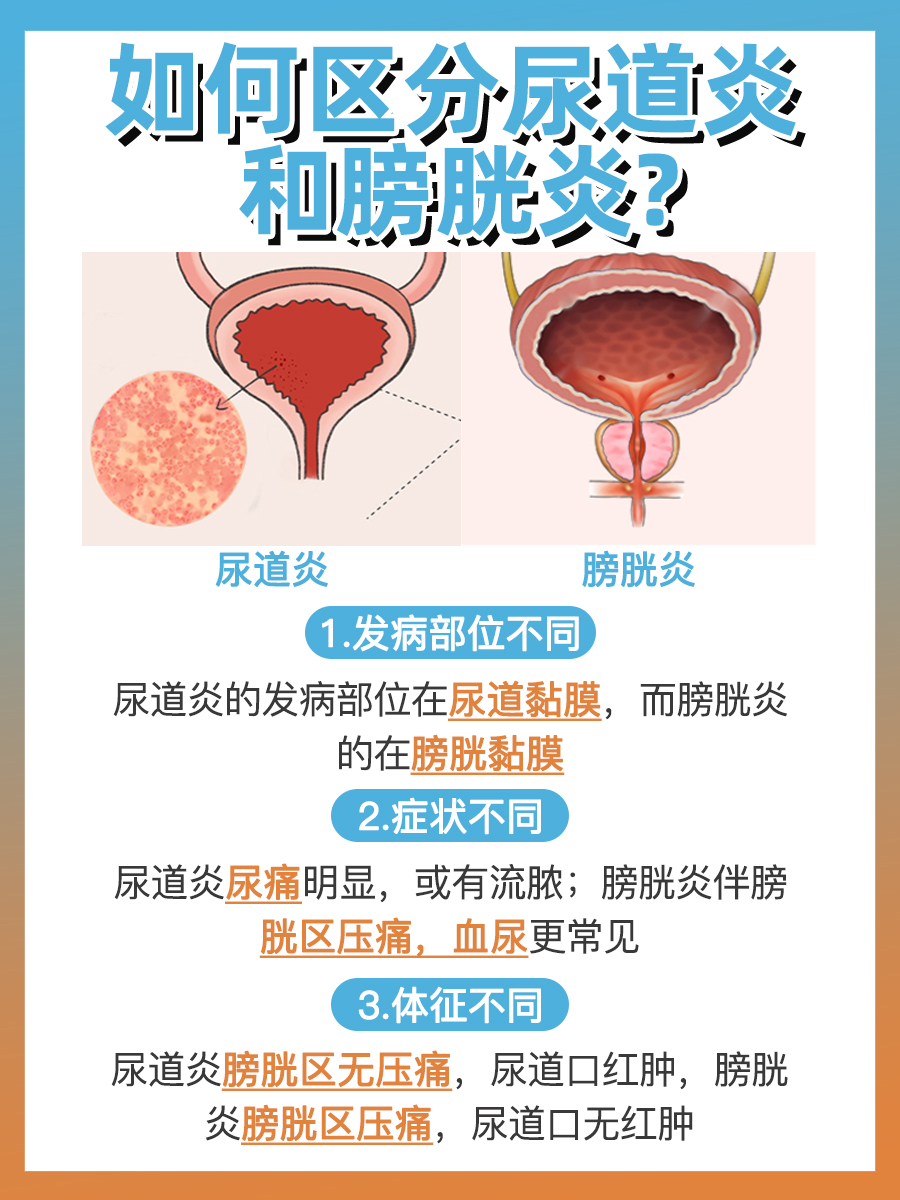 ​尿道炎VS膀胱炎？几招教你轻松辨别