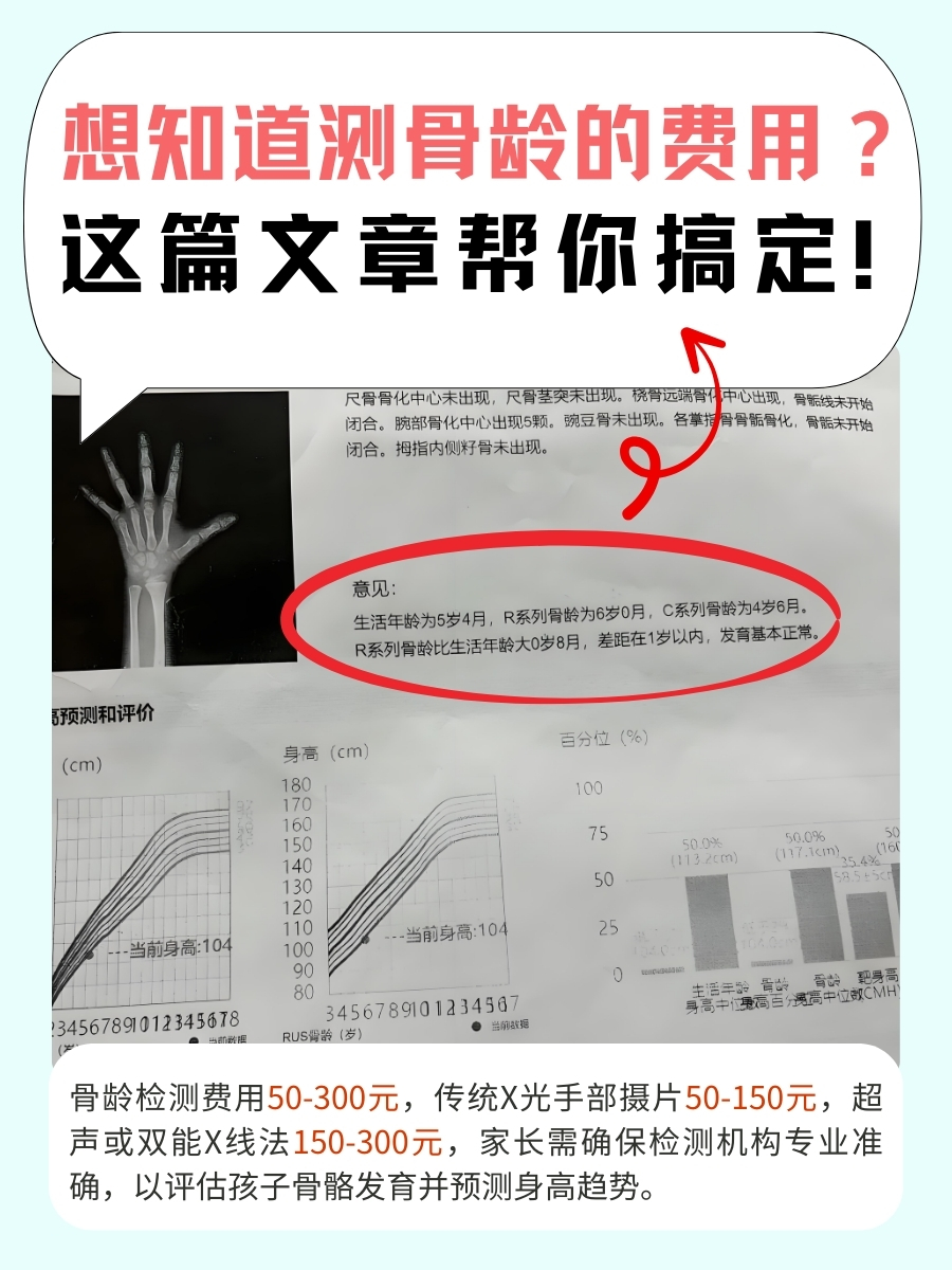 想知道测骨龄的费用？这篇文章帮你搞定！