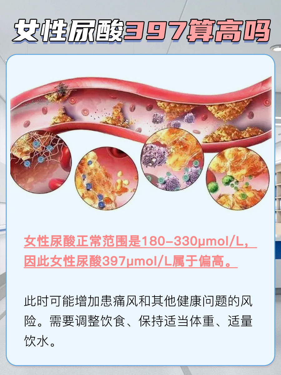 解析：女性尿酸397μmol/L算高吗？