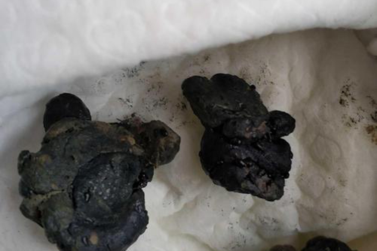 假黑便图 假黑便图