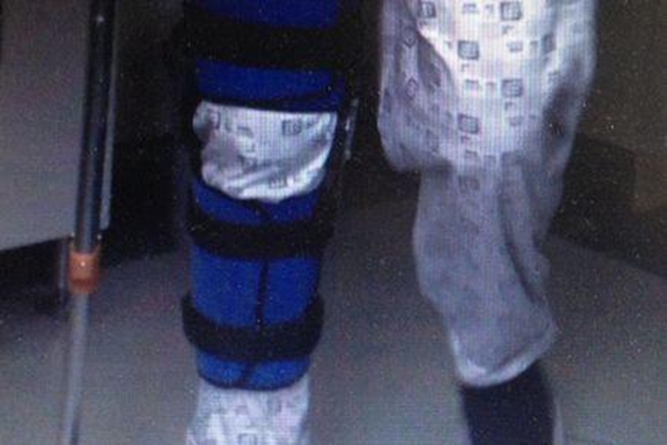 髌骨骨折非负重行走图