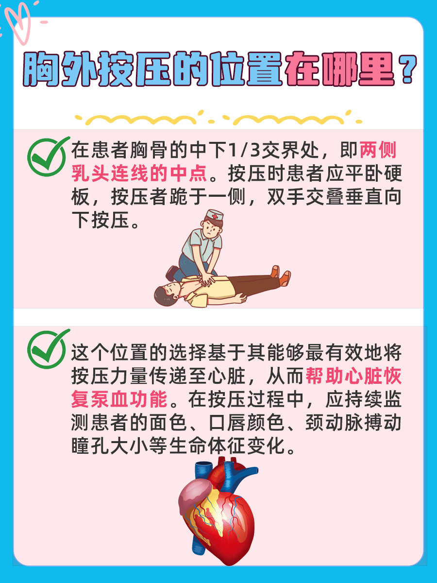 胸外按压的位置在哪里？一文解析