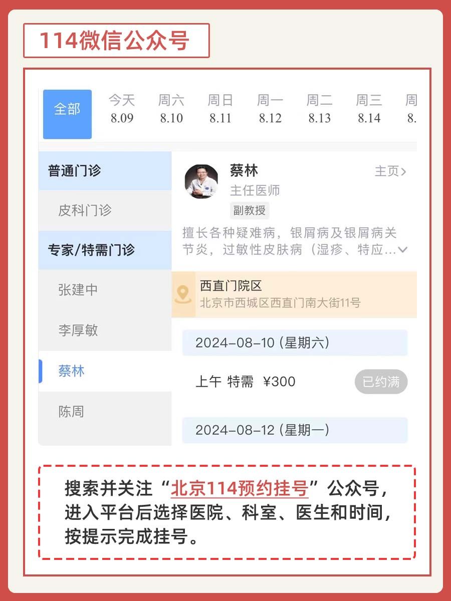 北大人民医院蔡林医生怎么样?怎么挂号?