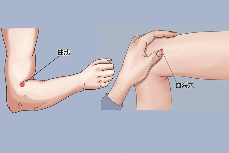 曲池穴、血海穴位置图 曲池穴、血海穴位置图
