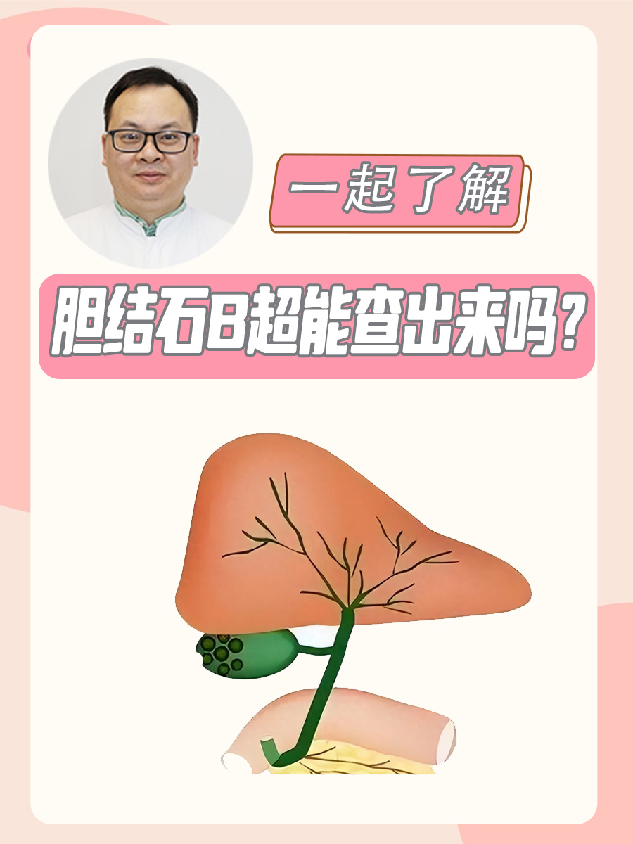 一起了解：胆结石B超能查出来吗？
