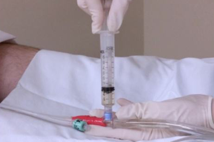 推注器连接尿管图