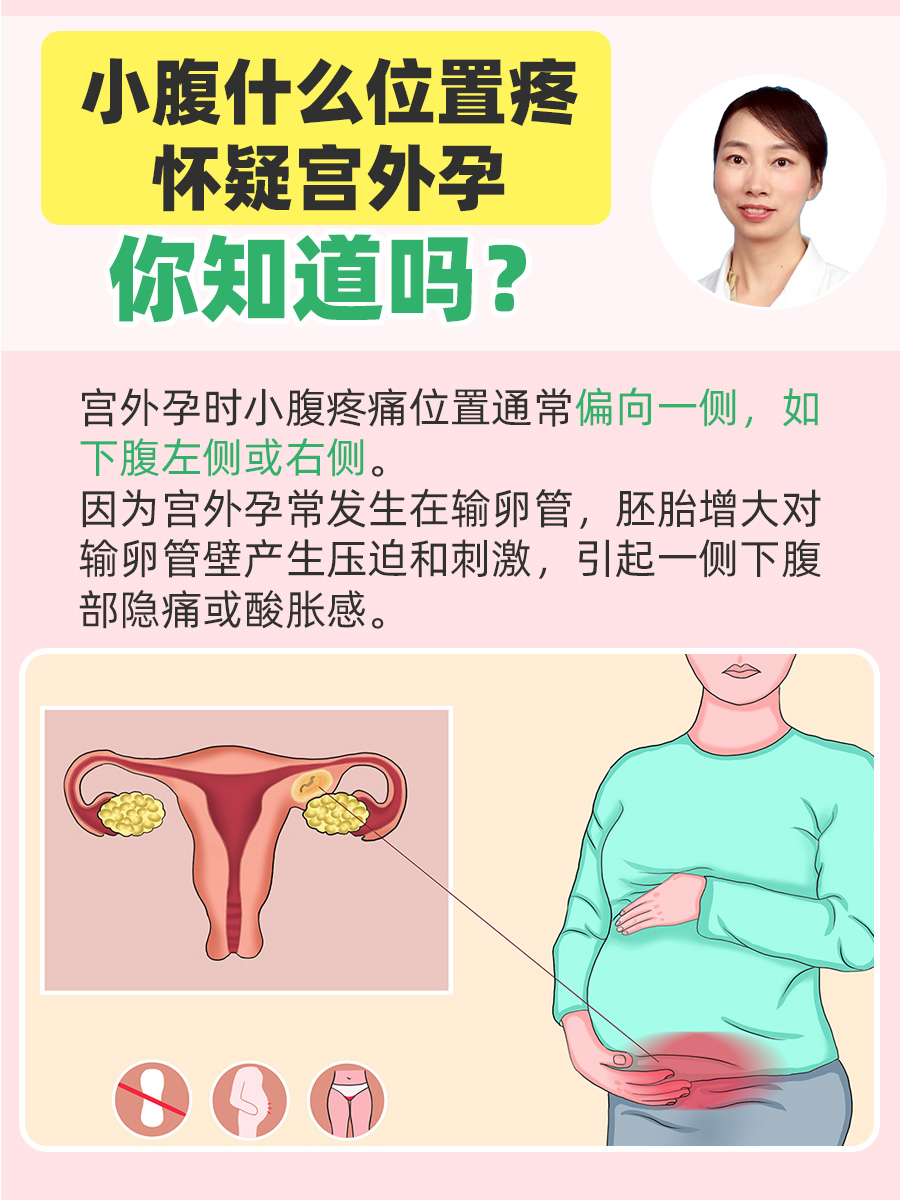 小腹什么位置疼怀疑宫外孕：你知道吗？