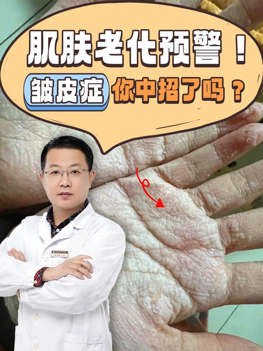 肌肤老化预警！皱皮症你中招了吗？