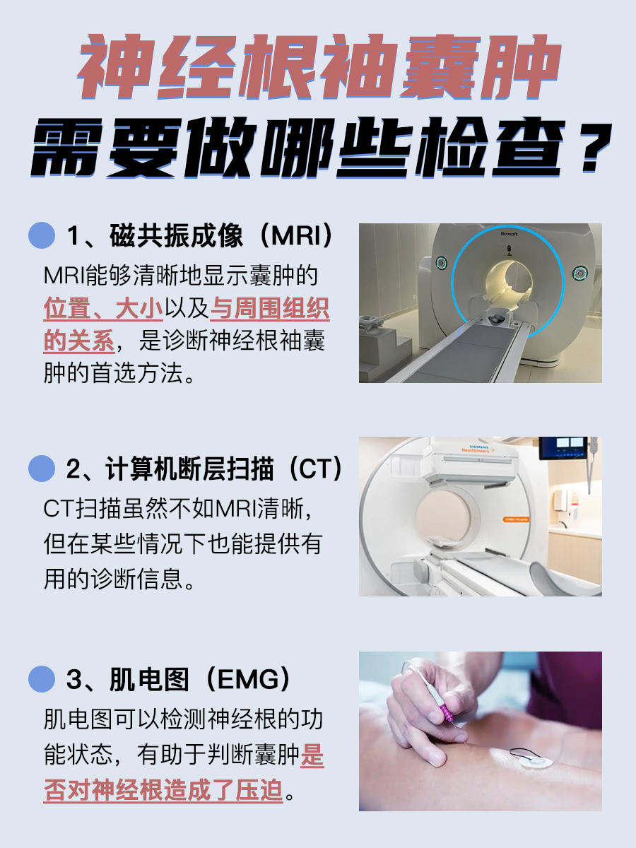 神经根袖囊肿是什么?一文带你全面了解