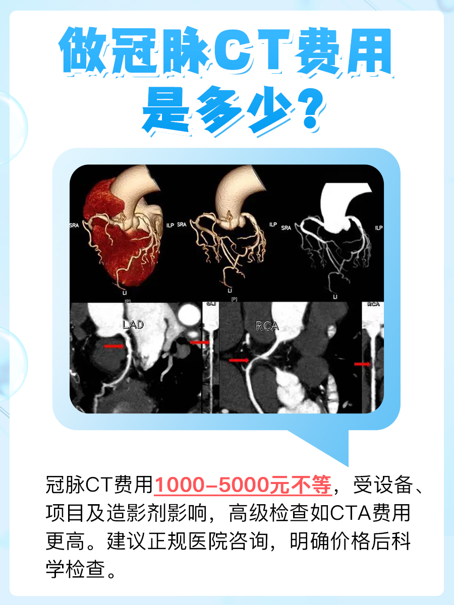 做冠脉CT多少钱？医生告诉你