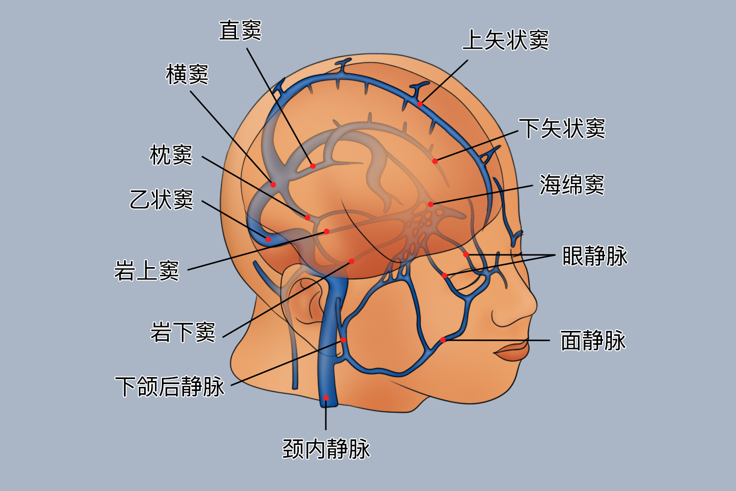 硬脑膜静脉窦图