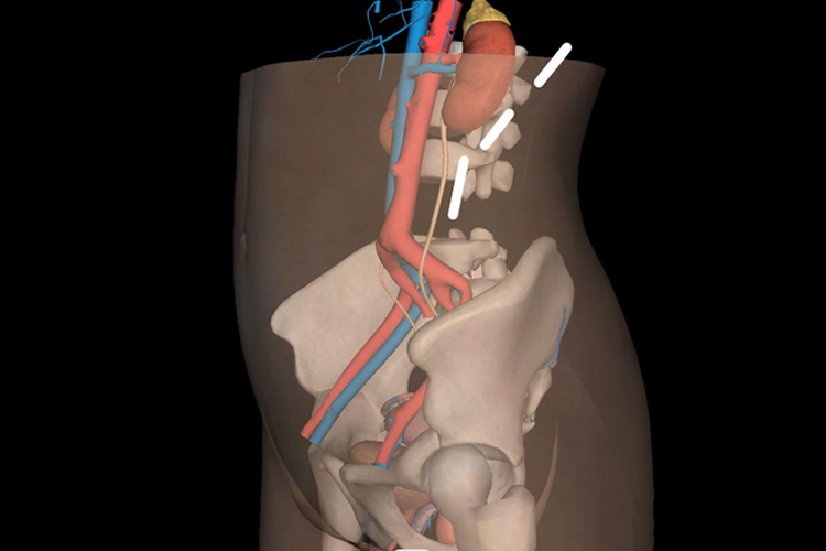 侧卧位输尿管超声手法图