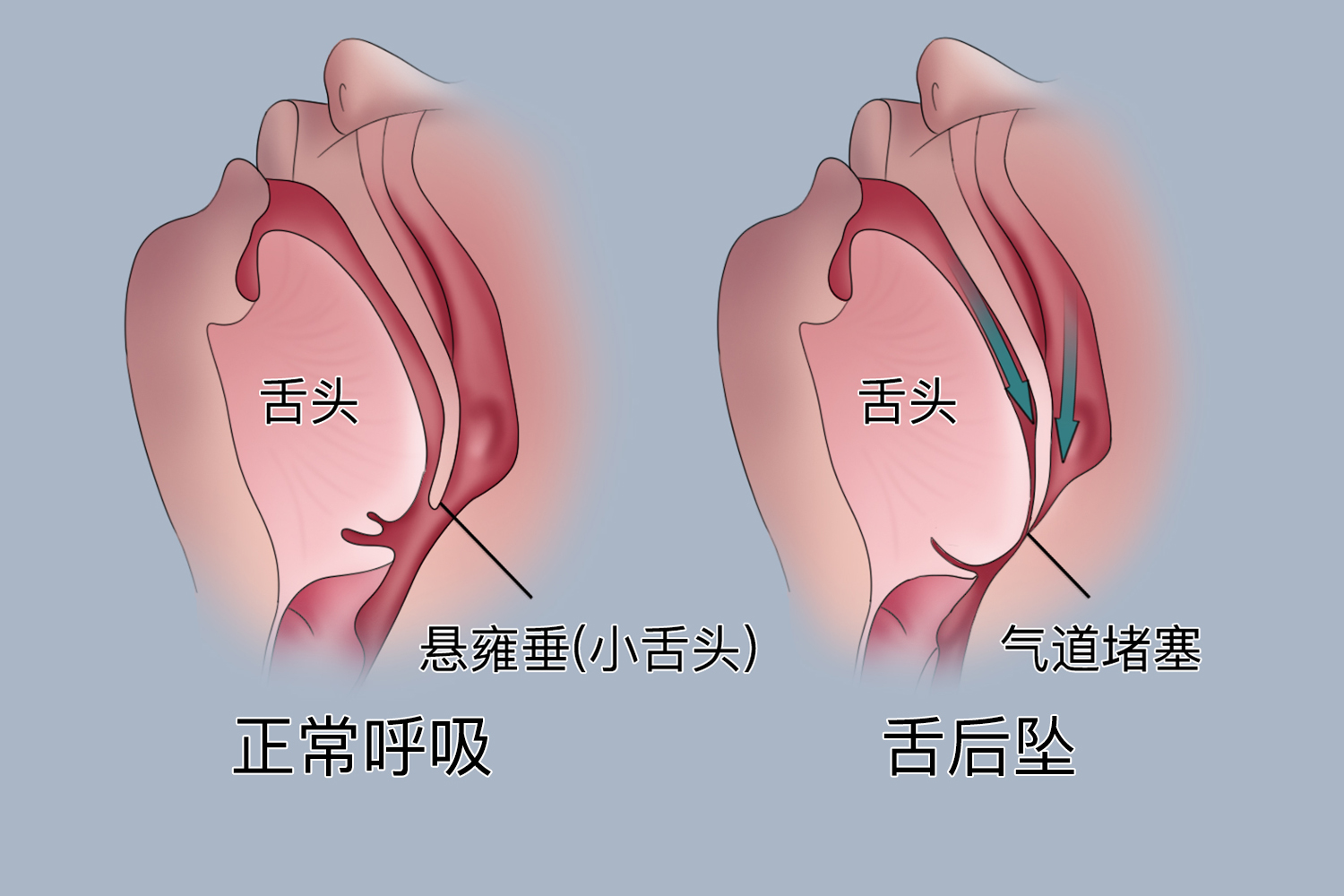 舌头构造真实示意图图片