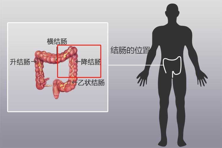 结肠位置图