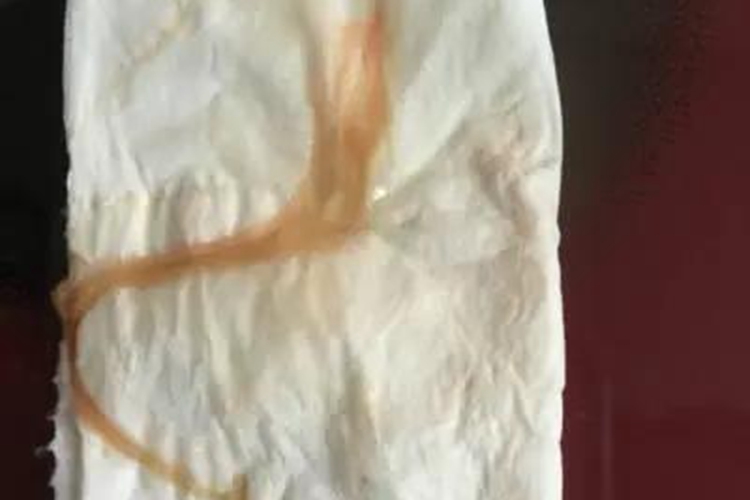 足月见红淡红色出血图