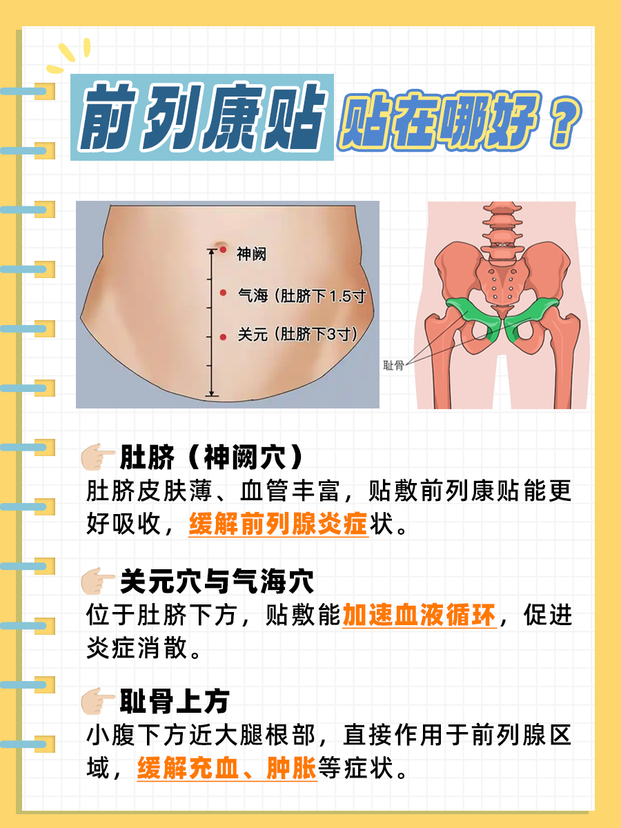 前列康贴贴在哪最有效？答案来了