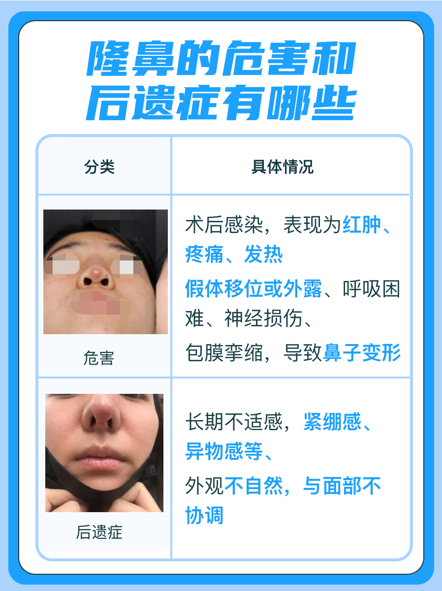 隆鼻有什么危害和后遗症吗?一文解析