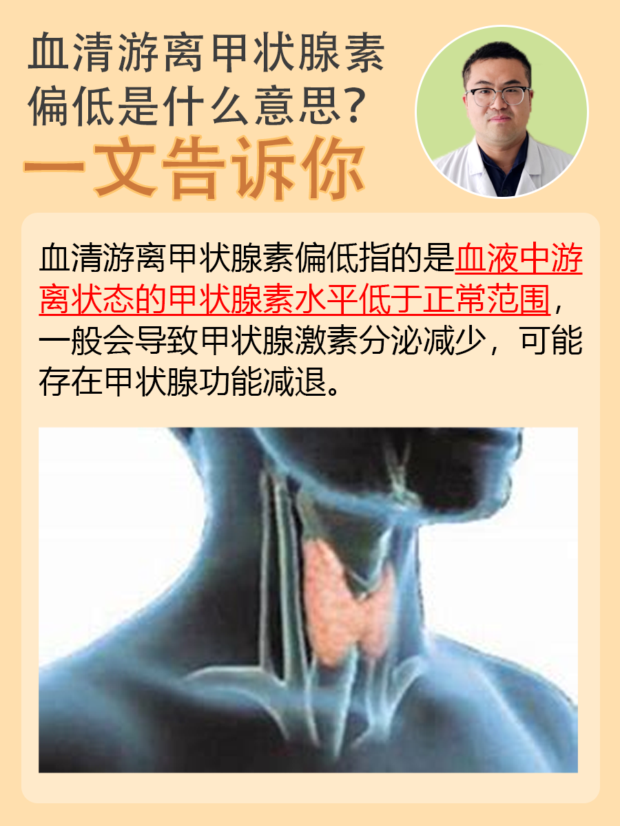 血清游离甲状腺素偏低是什么意思？一文告诉你