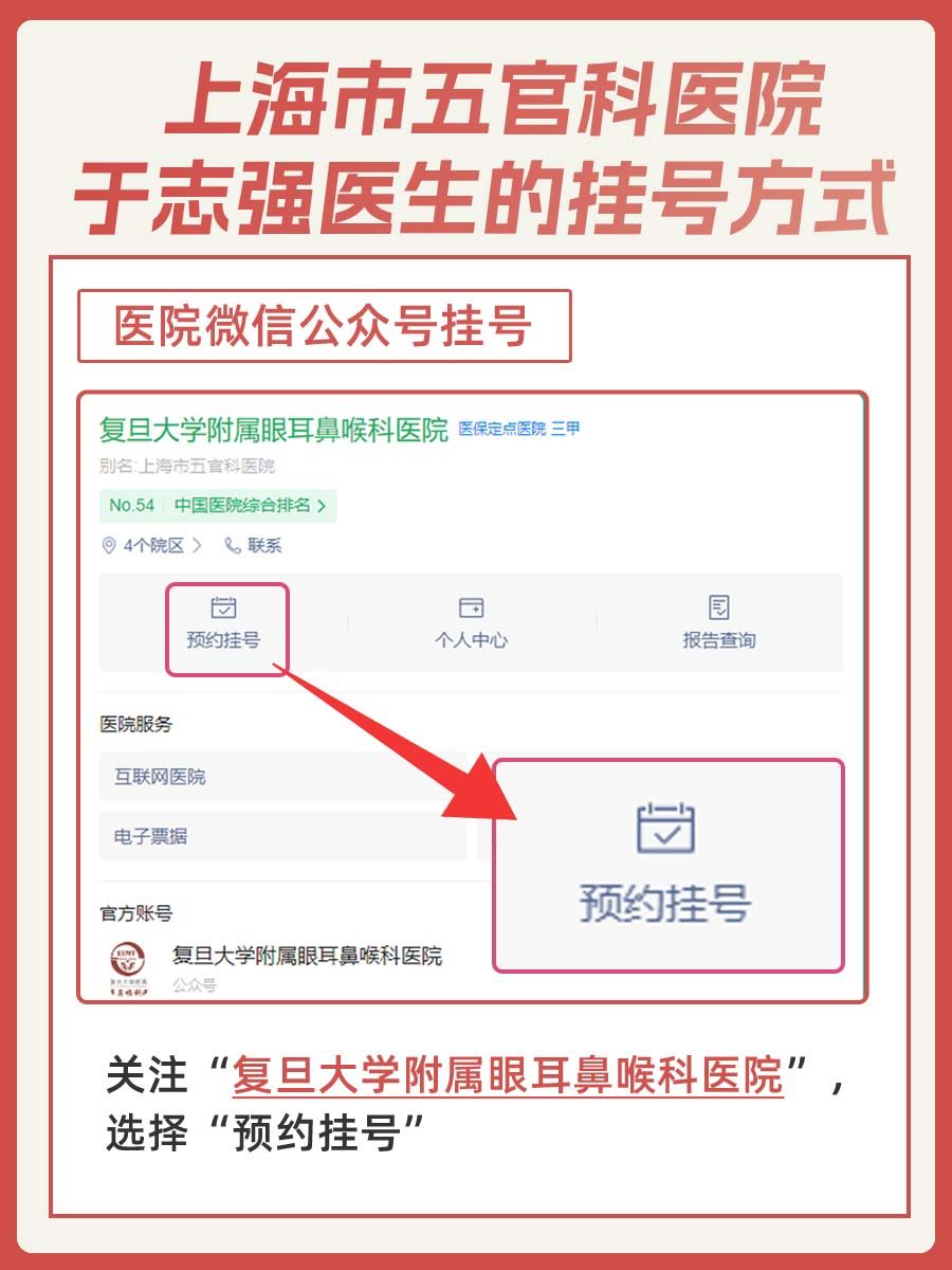 上海市五官科医院于志强医生怎么样？怎么挂号？