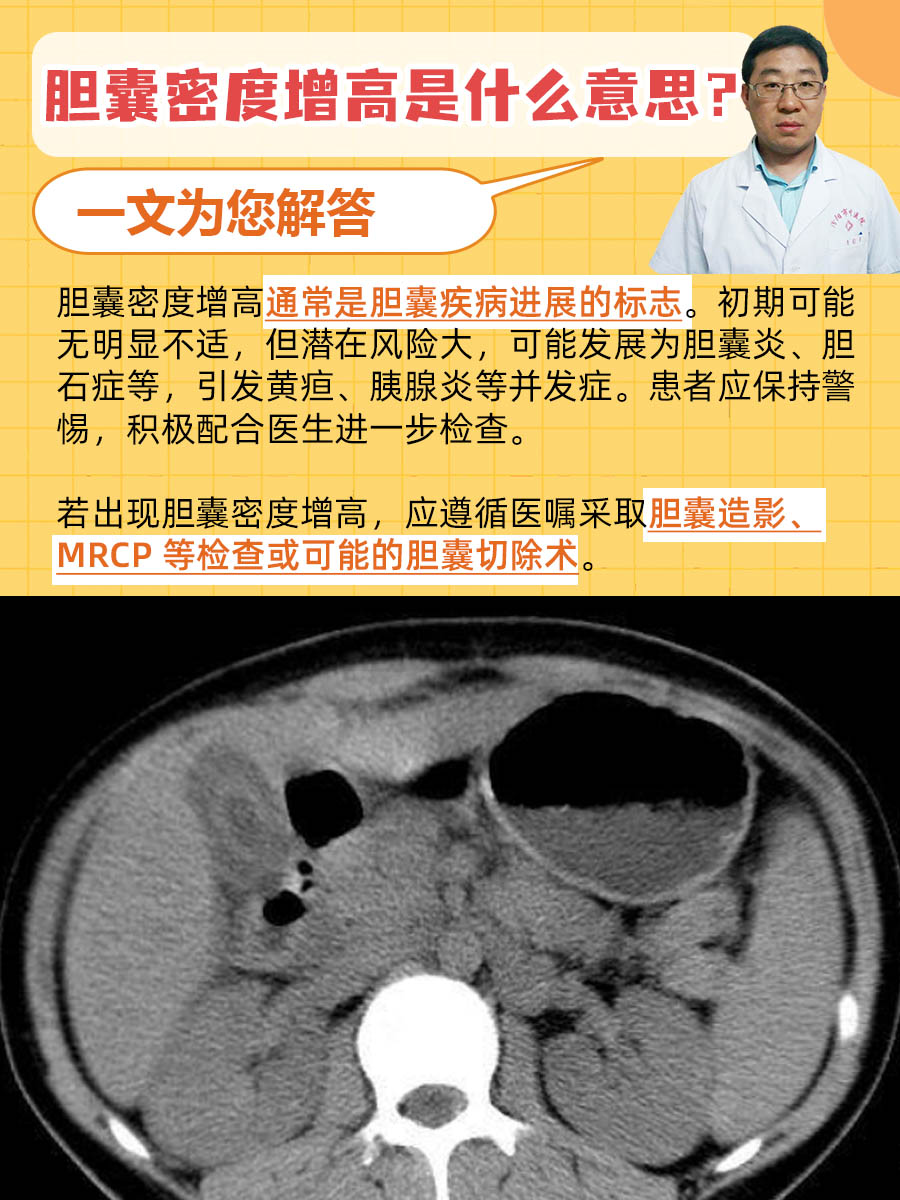 胆囊密度增高是什么意思？一文为您解答