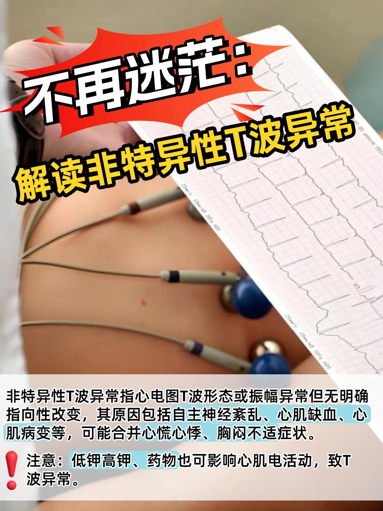 不再迷茫：解毒非特异性T波异常
