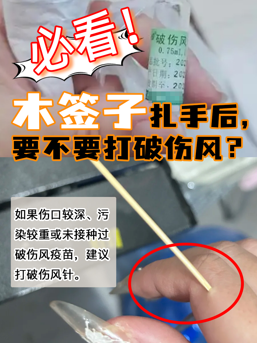 必看！木签子扎手后，要不要打破伤风？