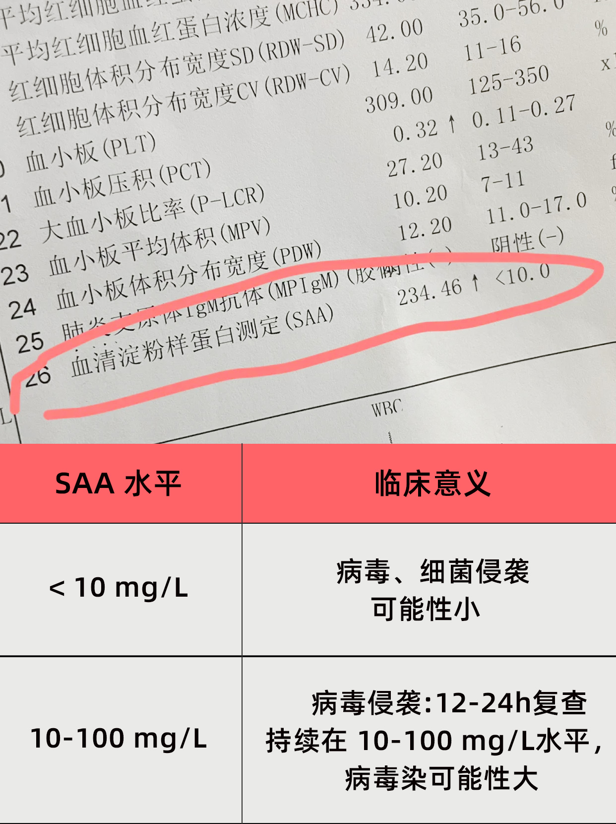 不懂就问，血清淀粉样蛋白高出多少就是危险？