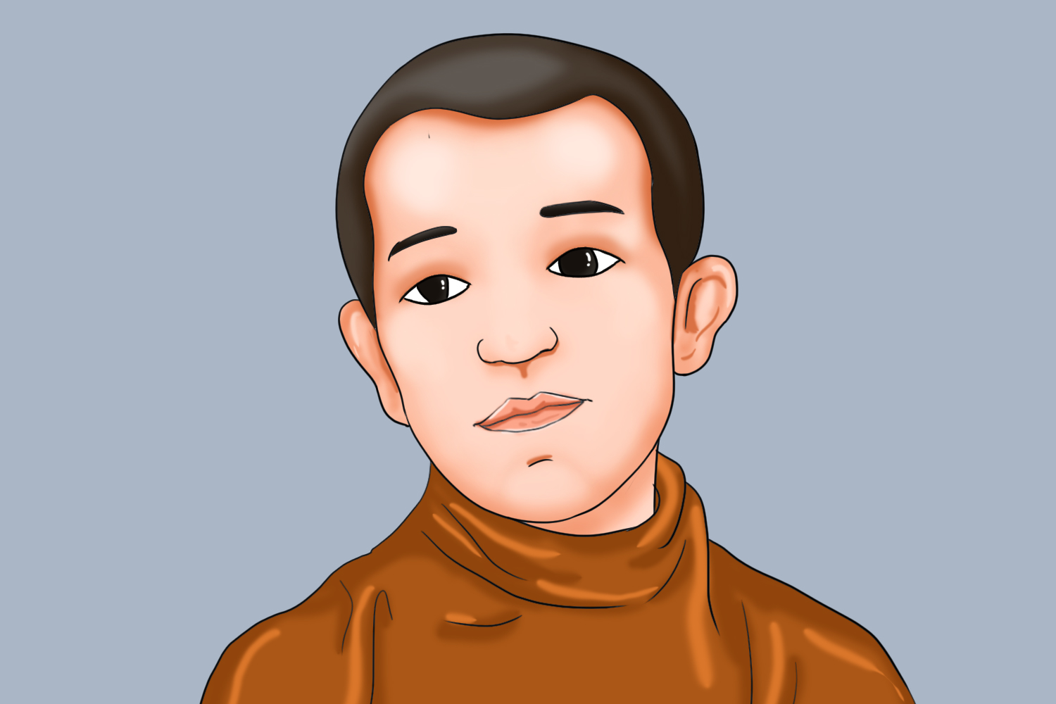 脆性x综合征特殊面容图